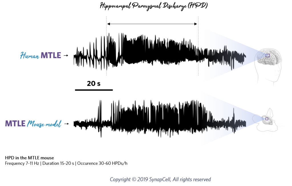MTLE-HPD-explained-translational-synapcell