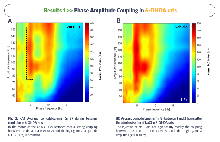 Phase Amplitude Coupling